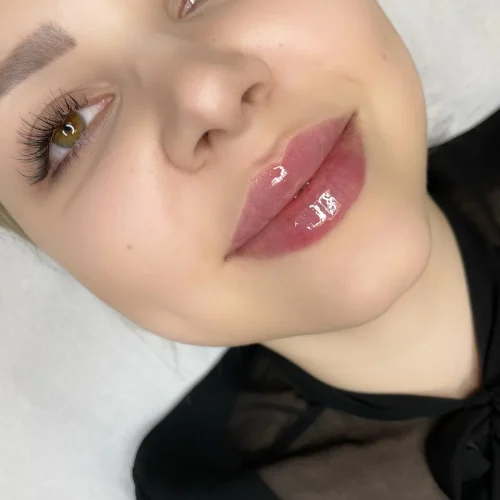 Efekty zabiegu modelowania ust Rzeszow Aleksandra Walas Estetic