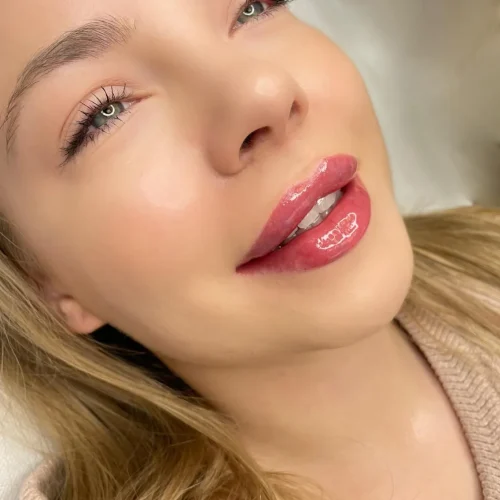 Efekty zabiegu modelowania ust Rzeszow Aleksandra Walas